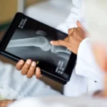 Indonesia menyetujui penggunaan kecerdasan buatan (AI) untuk skrining osteoporosis asal Taiwan