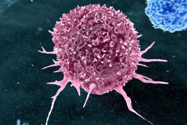 Sebagian besar kanker yang dapat dicegah berkaitan dengan hanya dua kebiasaan gaya hidup